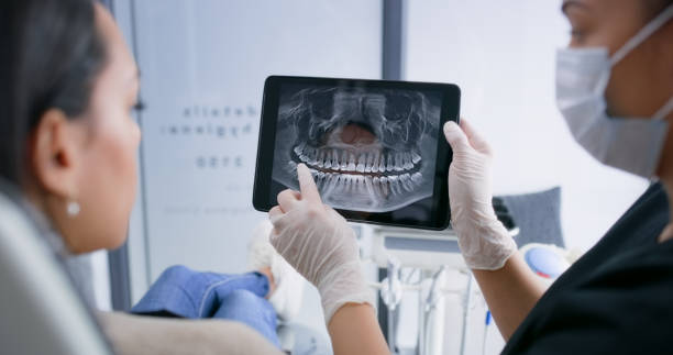 Licensed Dental Implants service in Calistoga, CA - Smile Center Dentistry