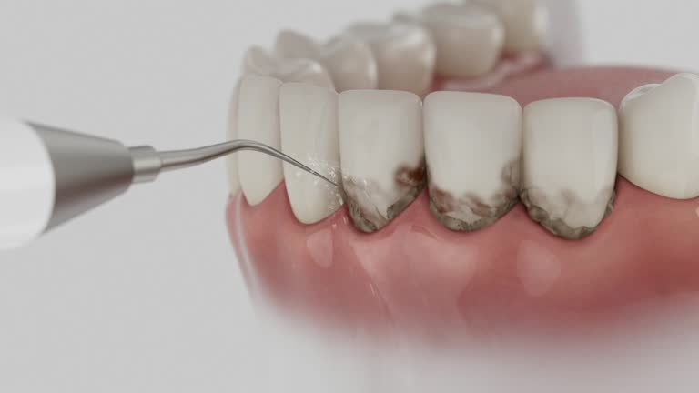 Reliable Dental Implants contractor in Calistoga, CA by Smile Center Dentistry